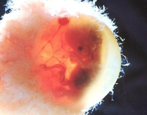A black hole looking like an embryo coild be the last thing you see in the Enlightenment of that which is One